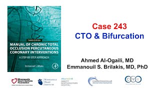 Case 243 Manual of CTO PCI  CTO amp bifurcation [upl. by Starks]