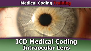 Medical Coding Test Questions — ICD 9 Code for Intraocular Lens [upl. by Ayikin]