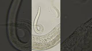 Phylum Aschelminthes Nematoda Roundworms [upl. by Sudderth]