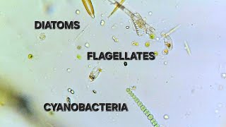 Diatoms Flagellates and a Cyanobacteria  400x [upl. by Ahseim457]