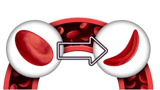 Como Bajar la Hemoglobina Glicosilada el Azúcar en 3 meses [upl. by Rufus]