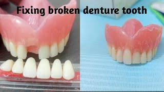 How to fix broken denture tooth [upl. by Pik]