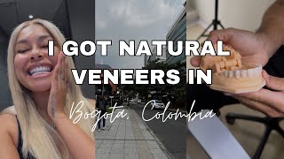 VENEERS VLOG  GOING TO COLOMBIA FOR NATURAL LOOKING PORCELAIN VENEERS [upl. by Inahs]