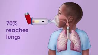 Asthma Inhaler with Spacer [upl. by Artep]