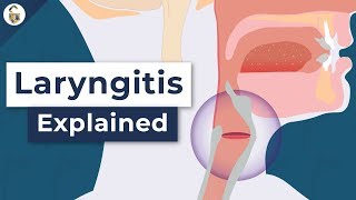 Why Do You Lose Your Voice  Laryngitis Explained [upl. by Adon]