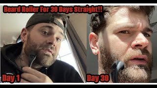 30 Day Beard Roller Before amp After [upl. by Nahttam]