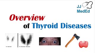 Overview of Thyroid Diseases Hashimoto’s Graves’ Sick Euthyroid Syndrome Toxic adenoma etc [upl. by Searcy559]