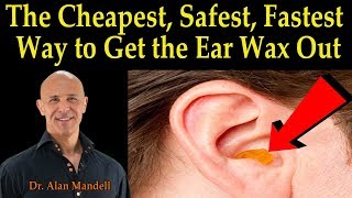 Cheapest Safest Fastest Way to Get the Ear Wax Out  Dr Alan Mandell DC [upl. by Lizzie]