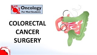 Colorectal Cancer Surgery principles and types [upl. by Eanehs]