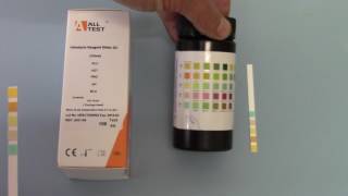 how to use a urine dipstick [upl. by Schreck]