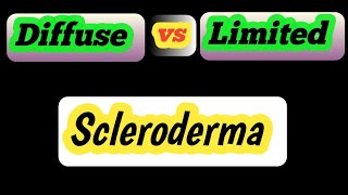 diffuse vs limited scleroderma [upl. by Botnick]