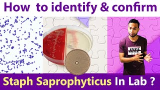 How to identify amp Confirm Staphylococcus Saprophytes in Laboratory [upl. by Ekram]