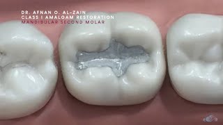 Class I amalgam restoration – Mandibular molar 47  Arabic عربي [upl. by Ennaeilsel]