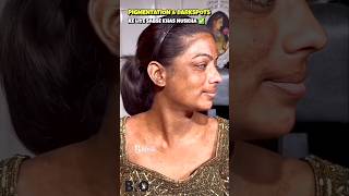 ✅How To Remove DARK SPOTS amp PIGMENTATION From Face Naturally shorts beautykadose [upl. by Aniretake]