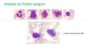 Les outils diagnostics en hématologie [upl. by Gilligan407]