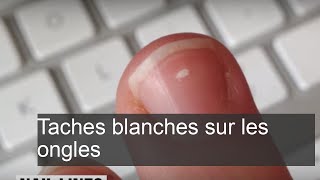 Taches blanches sur les ongles  Signification à prendre [upl. by Sices647]