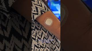 Testing the Medtronic Simplera CGM t1d diabetes [upl. by Anirad]