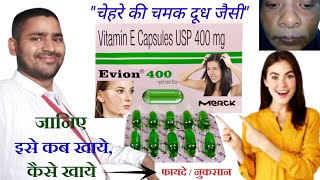 evion 400 for skin  evion 400 capsule for hair  evion 400 khane ke fayde  evion 400 uses in hindi [upl. by Tezzil705]