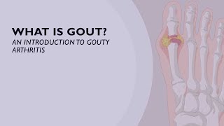 What is Gout An Introduction to Gouty Arthritis 1 of 6 [upl. by Millie]