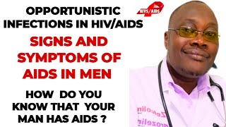 HIV Symptoms in Men Recognize the Warning Signs Earlyquot [upl. by Krm638]