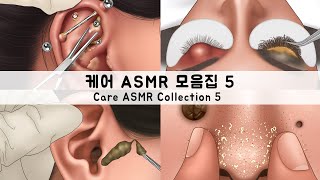 ASMR 케어 애니메이션 모음집5  귀지 피어싱 코피지 다래끼  CARE ANIMATION COLLECTION5  Earwax Piercing sebum stye [upl. by Surbeck]