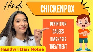 Chickenpox Explained in Hindi  Causes Signs amp Symptoms Diagnosis amp Treatment [upl. by Yreffeg450]