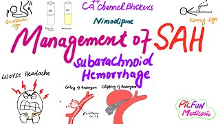 Management of Subarachnoid HemorrhageSAHbrain hemorrhage [upl. by Ojahtnamas14]