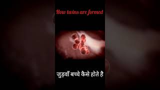 जुड़वाँ बच्चे कैसे होते हैhow twins are formedbaby pregnancy [upl. by Langer]