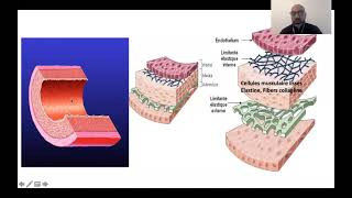 01 Rhumatisme ariculaire aigu Dr M Chettibi  Cardio [upl. by Jenni196]