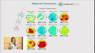 QEEG Electroencefalograma cuantitativo [upl. by Guise]