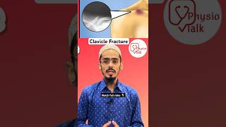 Everything You Wanted to Know About Clavicle fracture classification shorts clavicle [upl. by Osy120]