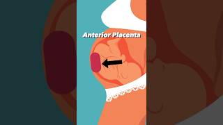 Anterior Placenta and Baby Kicks pregnancy [upl. by Thedrick]