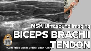 Musculoskeletal Ultrasound MSKUS Long head of Biceps Brachii [upl. by Yttak]