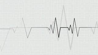 Understanding Heart rhythm [upl. by Lugo]