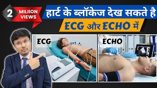 Can ECG and echocardiogram detect heart blockageMust Know facts [upl. by Htebsil]