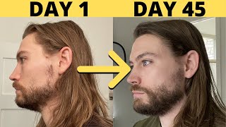 How To Grow MORE Facial Hair WITHOUT MINOXIDIL [upl. by Denman]