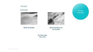 How does Optiflow work Mechanisms of action – HumidificationAirway hydration [upl. by Guy]