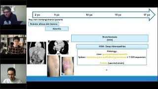 Granulomas in PID and other immune dysregulated conditions  Tuesday Lunch with RITA [upl. by Niwred227]