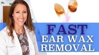 Clogged Ears  How to Remove Ear Wax At Home With Hydrogen Peroxide [upl. by Nerrual708]