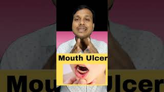 Mouth Ulcer And Treatment OF Mouth Ulcer [upl. by Malanie]