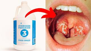 7 Unbelievable Uses For Hydrogen Peroxide YOU SHOULD KNOW [upl. by Nacul]