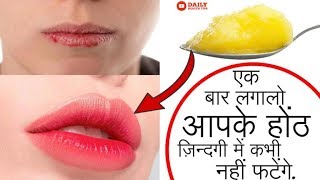 २ मिनटों फटे होंठ को बनाये खूबसूरत भीगे होंठ  Home Remedies To Get Rid Of Chapped Lips [upl. by Hestia]