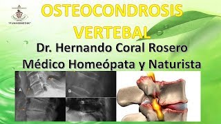 OSTEOCONDROSIS VERTEBRAL TRASTORNO QUE DEBILITA Y PIERDE EL TEJIDO MUSCULAR [upl. by Luisa955]