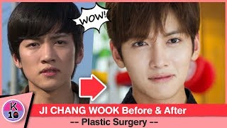 💬 Ji Chang Wook Before and After Plastic Surgery NETIZEN BUZZ [upl. by Ethelstan]