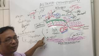 AsthmaBronchial AsthmapathophysiologyRefHarrisons Internal medicine and Robins pathology [upl. by Ahsiekel519]