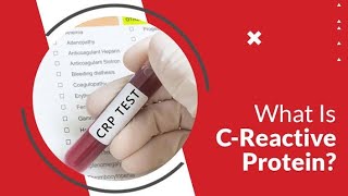 What is CRP TEST Dr Health Officials [upl. by Shannon887]