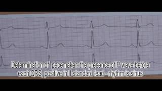 OSCE1Bogomolets National Medical UniversityRecording and analysis of ECGofficial [upl. by Ahcsap]