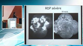 ADN 2018  Rétinopathie diabétique  Dr Mohamed BENNANI Casablanca [upl. by Oster]