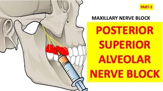 PSA POSTERIOR SUPERIOR ALVEOLAR NERVE BLOCK Oral surgery Nerve blocks Maxillary blockdental [upl. by Aigil156]