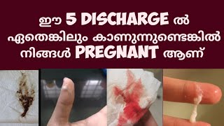 5 Pregnancy Discharge Deechus world Malayalam [upl. by Ayanat66]